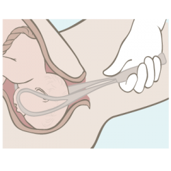 etapasembarazo (22)